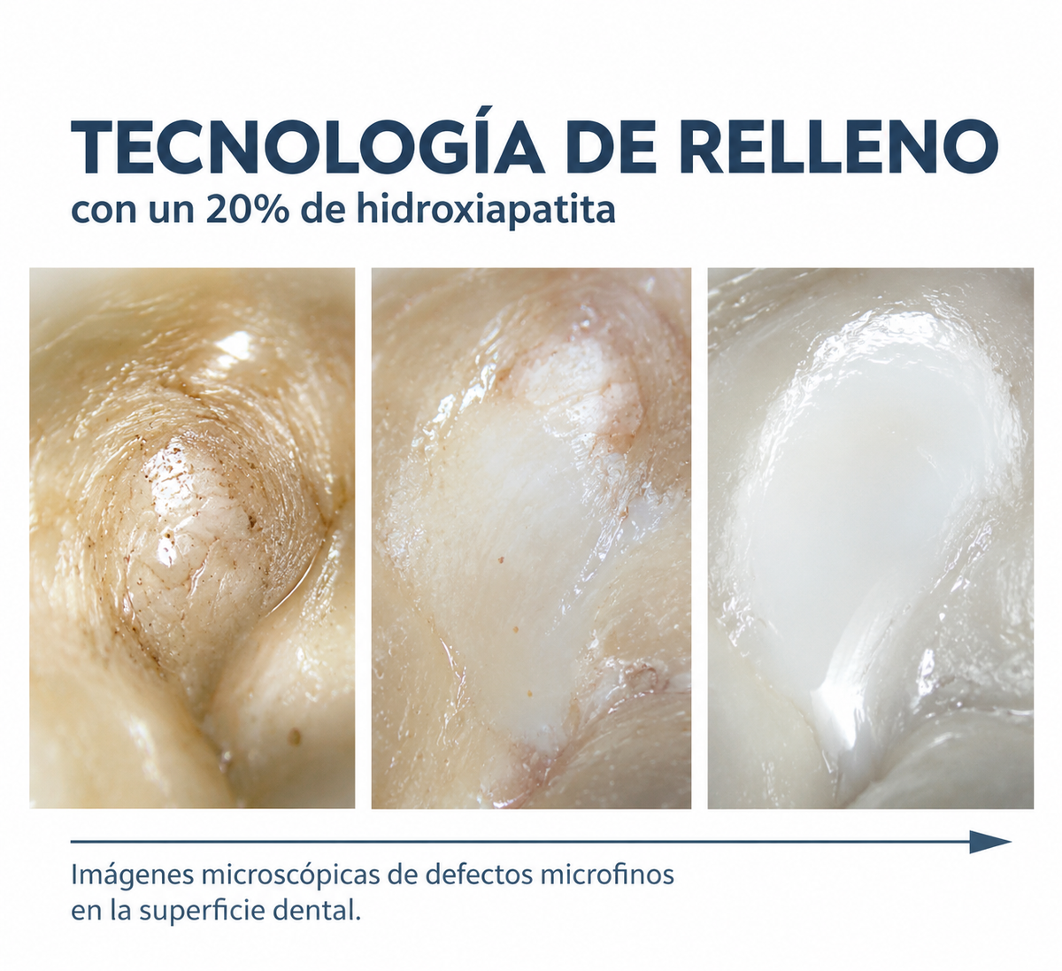 Tecnología de relleno con hidroxiapatita: imágenes de la superficie dental